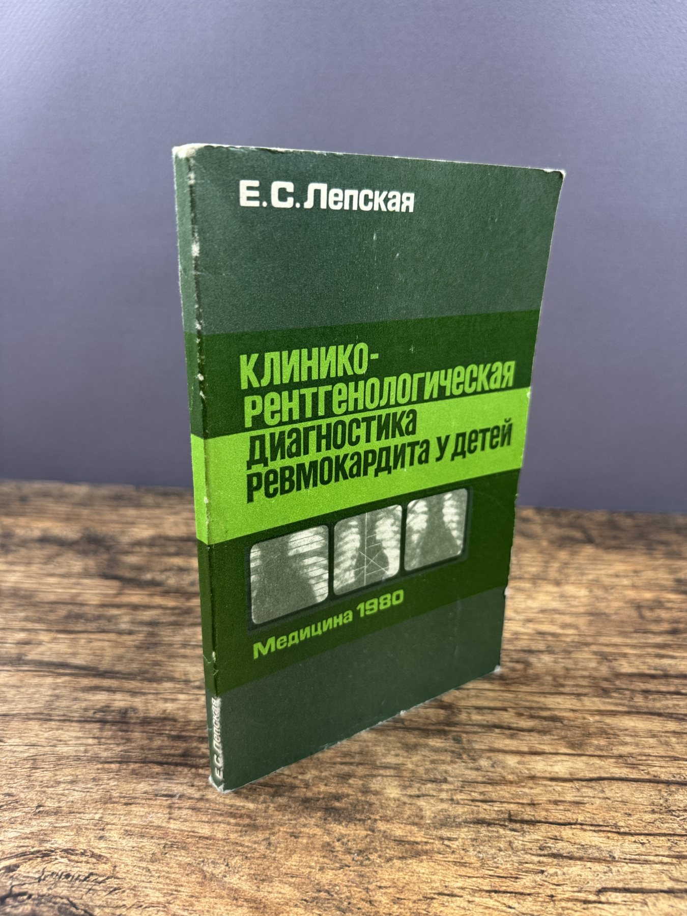 Клинико-рентгенологическая диагностика ревмокардита у детей